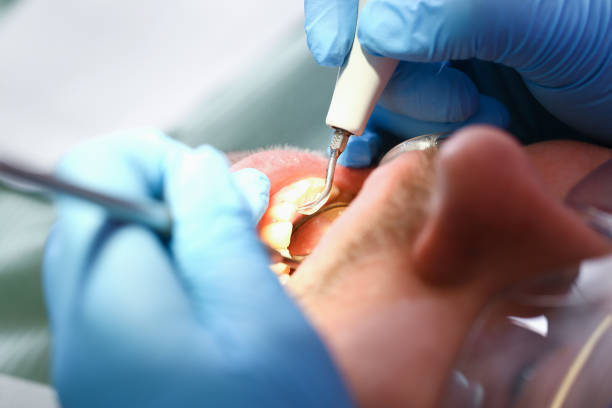 Best Weekend Emergency Dentist in Monticello, IA
