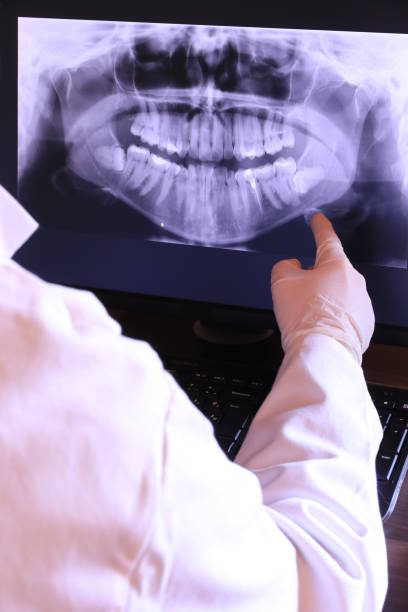 Best Emergency Tooth Extraction in Monticello, IA