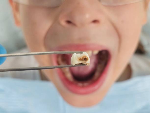 Best Emergency TMJ Treatment in Monticello, IA